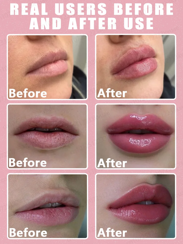 Long-lasting lip enhancement to make your smile more charming beauty enhancement product beauty product
