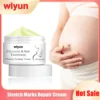 Remove Stretch Marks Cream Pregnant Women Repair Anti-Aging Anti-Winkles Sagging Increase Skin Elasticity Smoothing Firm Cream 1