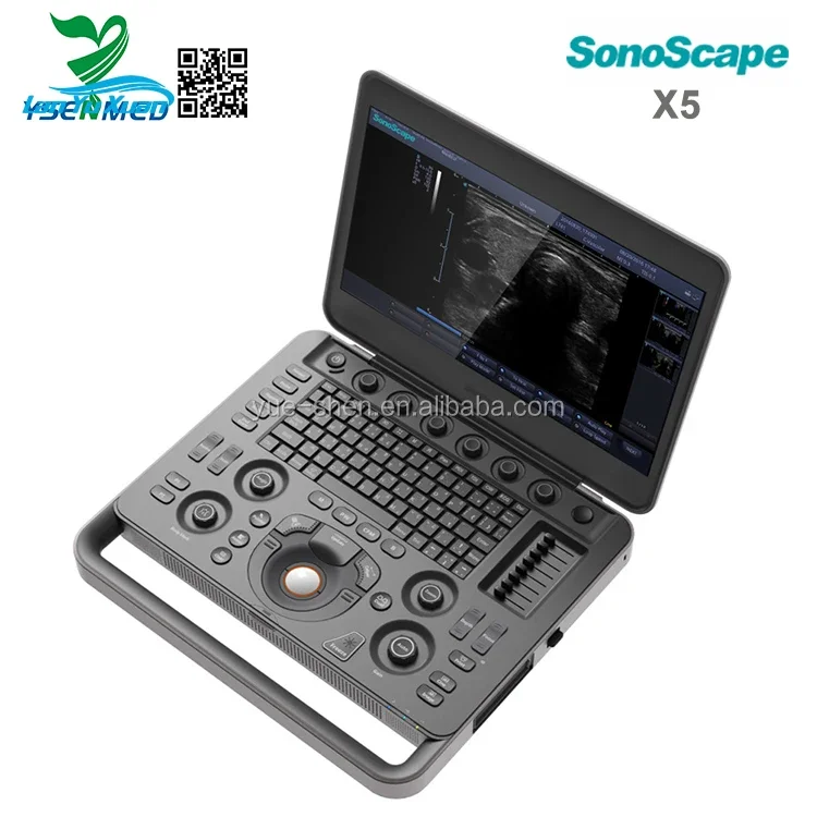 Рисунок 3 - Заводская цена, портативная 3D