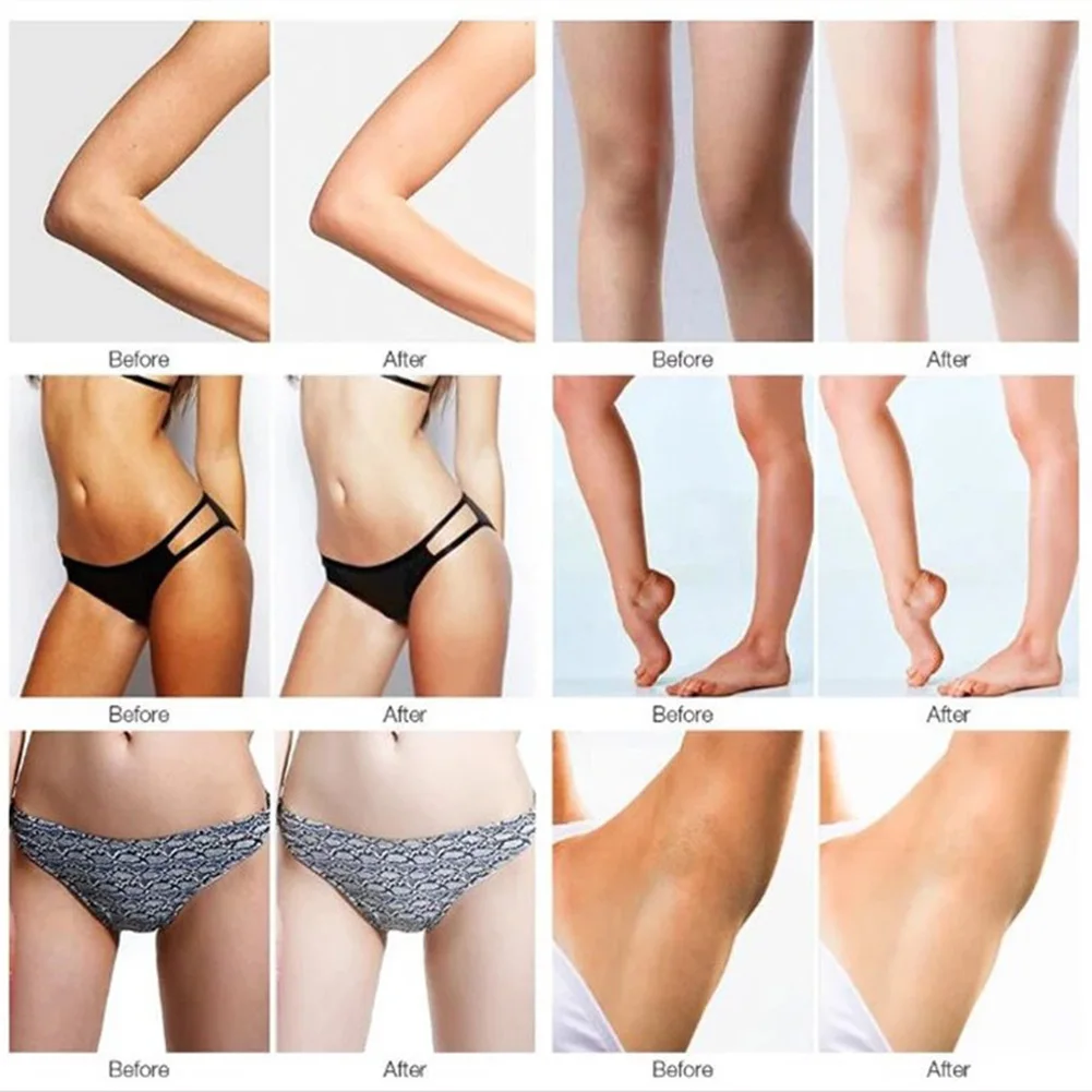 Vova Dark Spots Cream Whitening Cream Underarms Melanin Reduction Black Lines Fade Spots Whitening Skin Care