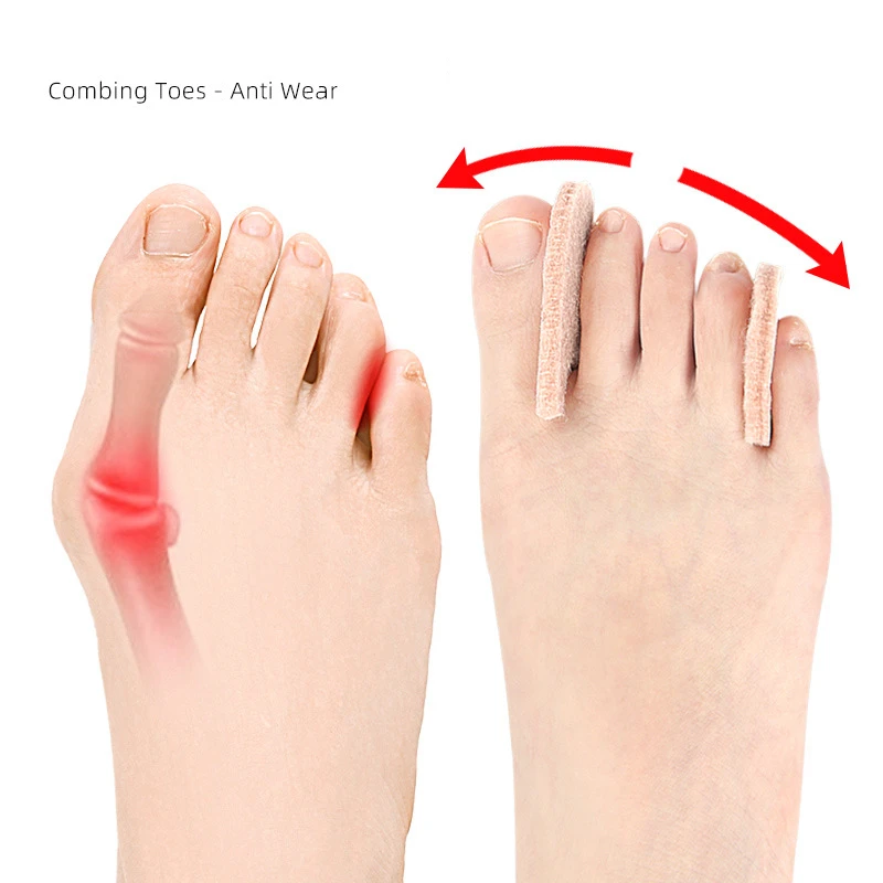Hallux Valgus Splitter Toe Spacer 10Pieces Overlapping Fingers Pedicure Separator Corrector Pain Relif Foot Care Correction