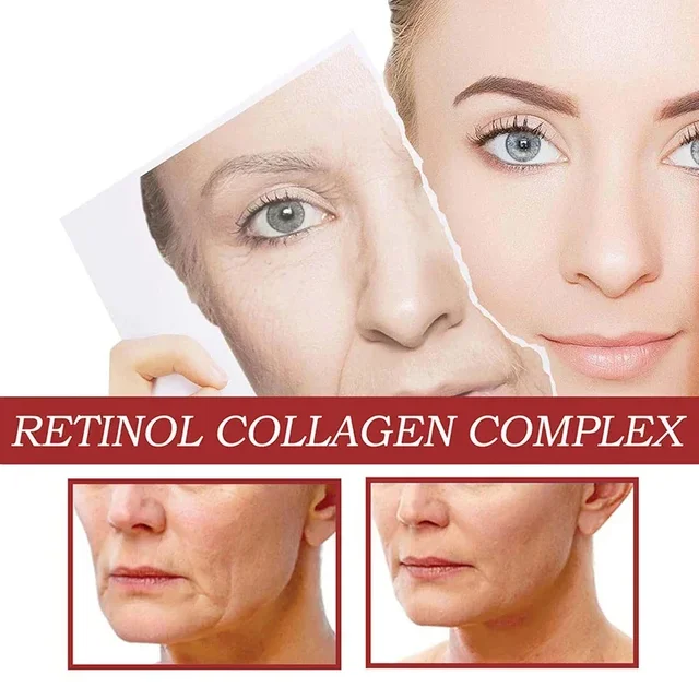 Retinol Eye Cream Collagen Multibalm Stick Reduce Wrinkles Eye Bag Hyaluronic Acid Anti Dark Circle Puffiness Eye Care Products 6