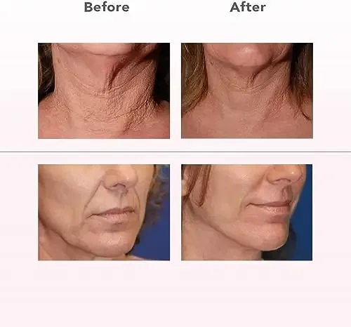 Firming Face, Neck & Body-Lift & Firm Skin,Professional Home Anti-Aging Non-Invasive Skin Care Machine,Cordless Portable