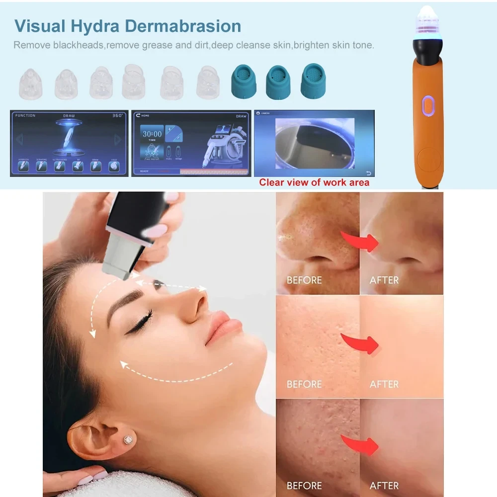 Hydroxydermabrasion 기계, 버블 회춘 장비, 페이스 리프트, 뷰티 케어