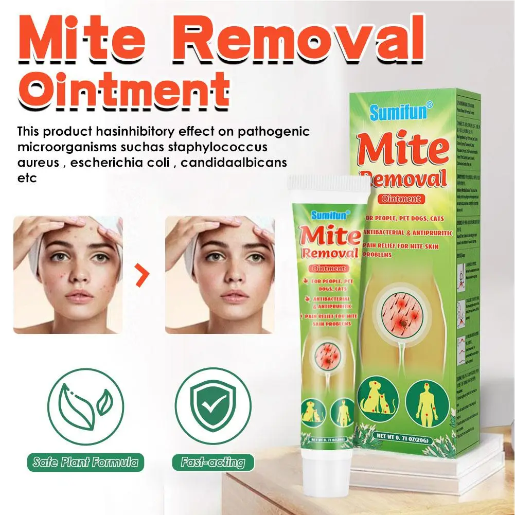 Mite Removal Ointment Anti Itching Scabies Kill Head Lice Treatment Care Cream Mite And Lice Care Cream Support