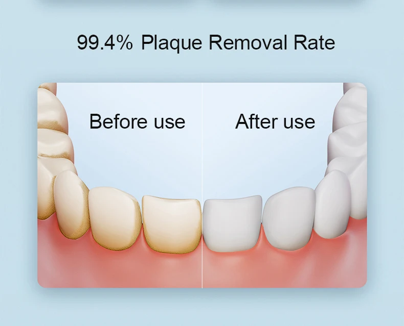 Sad40106f88644ff1a91b662621ecc6b6X