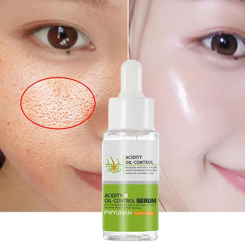 Lactic Acid Pore Shrink Serum Oil Control Exfoliating Acne Marks Repair Firming Pore Smooth Skin Whitening Face Care Cosmetics