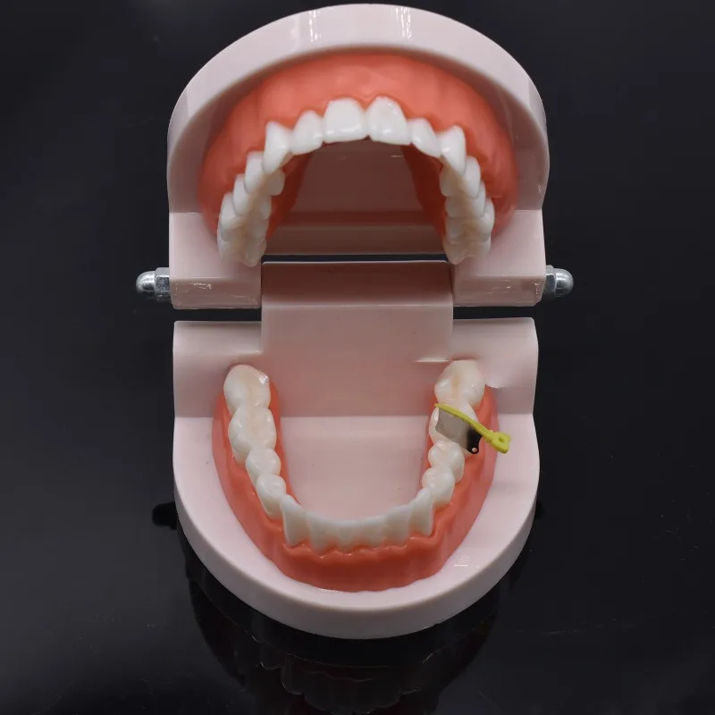 Рисунок 4 - стоматологическая клиновидная 
