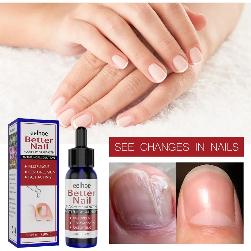 

Сыворотка для ухода за ногтями уход за руками Уход за ногами Лечение грибка ногтей эссенция для восстановления ногтей сияние ногтей восстанавливающее масло для ногтей Красота здоровья