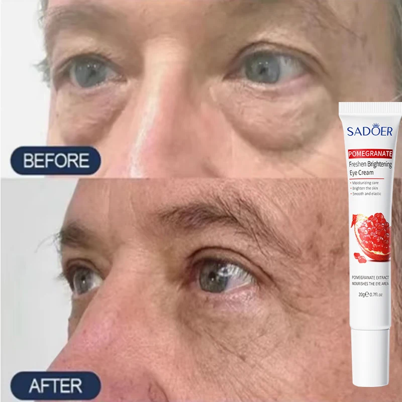 Retinol Eye Cream Remove Dark Circles Eye Bags Puffiness Reduce Wrinkle Serum Stick Dark Circles Removal Man Woman Care