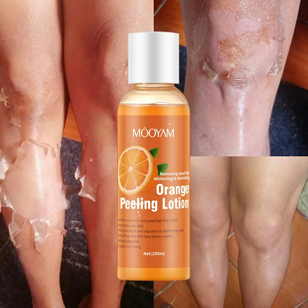 

Yellow Peeling Oil Bleaching Dark Skin Lighten Elbows Serum Knees Hands Whitening Even Body Effective Skin 100ml Tone K5N3