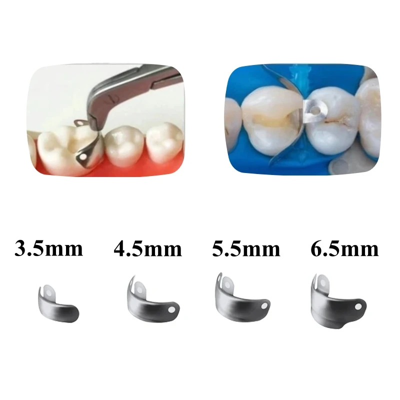 マトリックス リング 歯科用マトリックス バンド リング セクショナル マトリックス