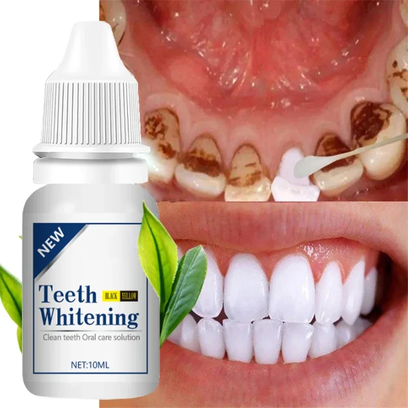 

Tooth Whitening Powder Whitening and Brightening Tooth Paste Quick acting Stones, Smoke Stains, and Dental Stains Oral Cleaning