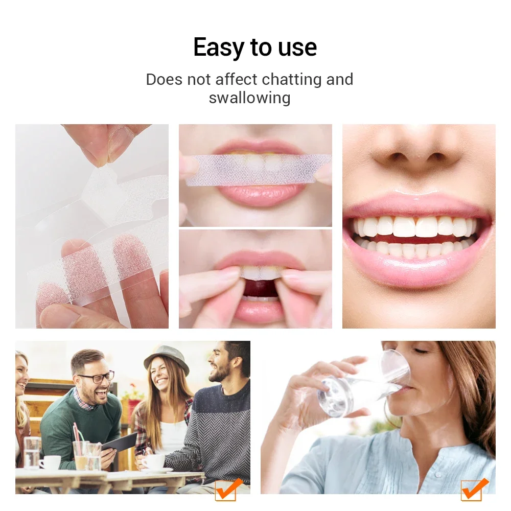 

Sdattor 5D Teeth Whitening Strips 14pcs Tooth Whitener kit Oral Hygiene Care Strip for false Teeth Dental Bleaching System Gel f