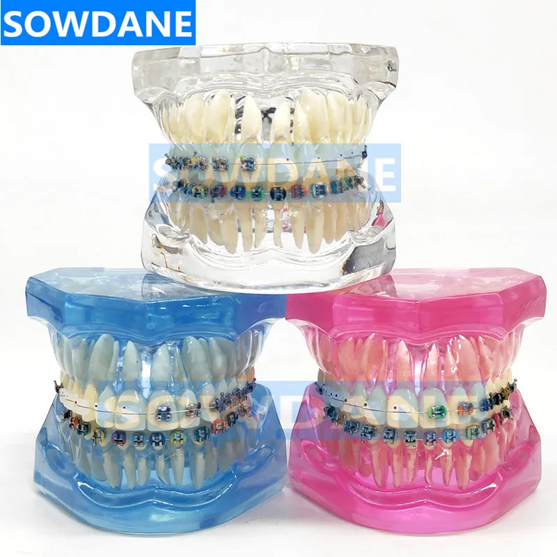 Dental Orthodontic Teeth Tooth Model with Ceramic and Metal Brackets