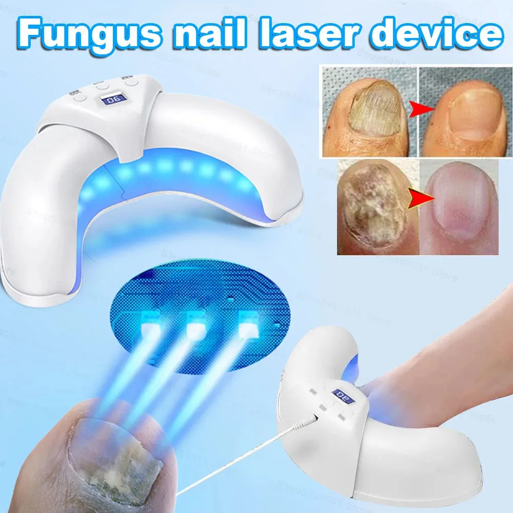 Toenail Fungal Nail Laser Treatment Repair Fast Nails Fungus Onychomycosis Repair Removes Foot Fingernail Nail Fungus Device