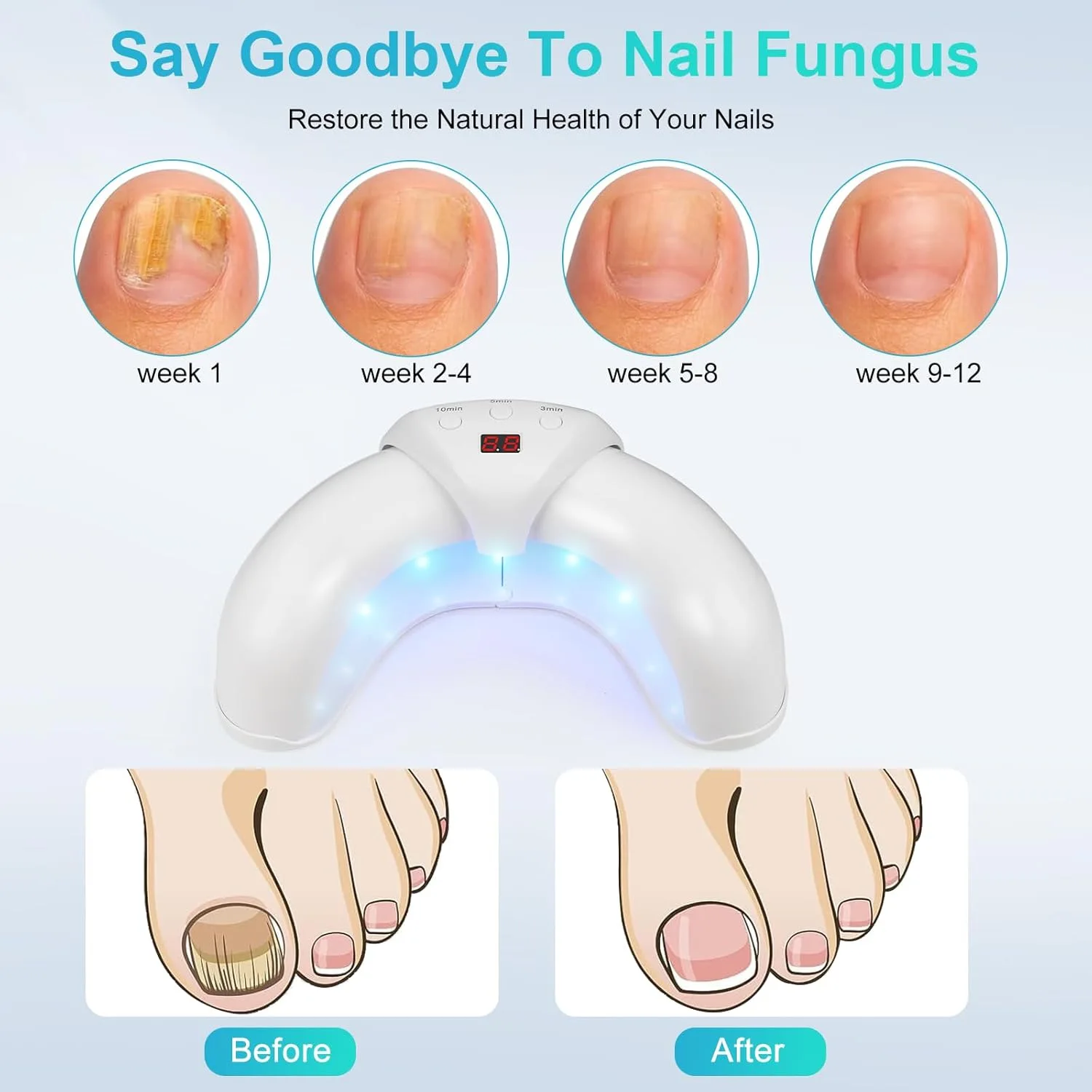 Fungal Nail Device for Rapid Repair of Nails Fungal Onychomycosis Repair of Toenails Removal of Nail Fungi and Treatment