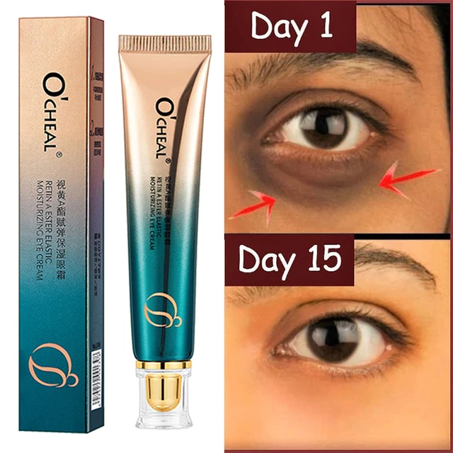 2022 Anti-Wrinkle Eye Cream Fades Fine Lines Anti Dark Circles Eye  1
