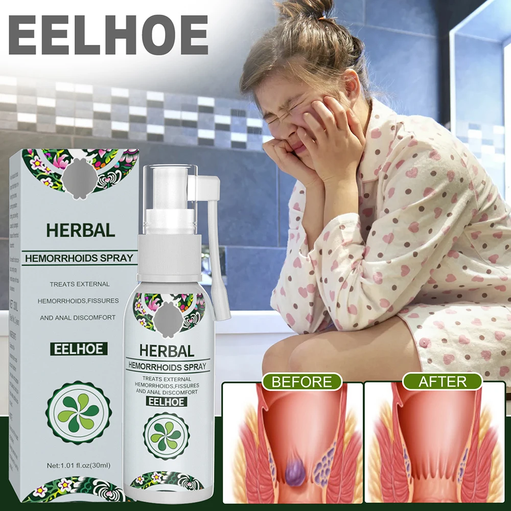 

New Hot Herbal Hemorrhoids Spray Effective Alleviate Pain Hemorrhoids Treatment Agent Herbal Hemorrhoids Spray For Women