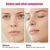 Fruity lip balm boxed, moisturizing, moisturizing, anti-drying and cracking, fading lip pattern makeup 3