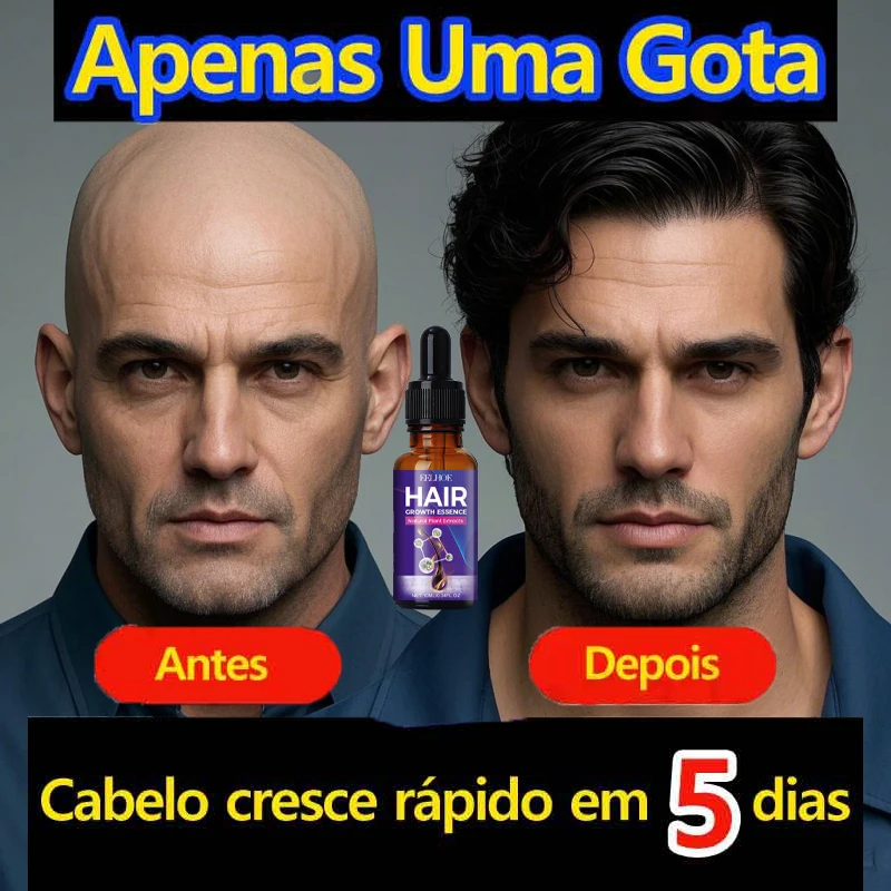 Effective Hair Growth Oil Loss Repair Genetic Hair Loss Postpartum Seborrheic