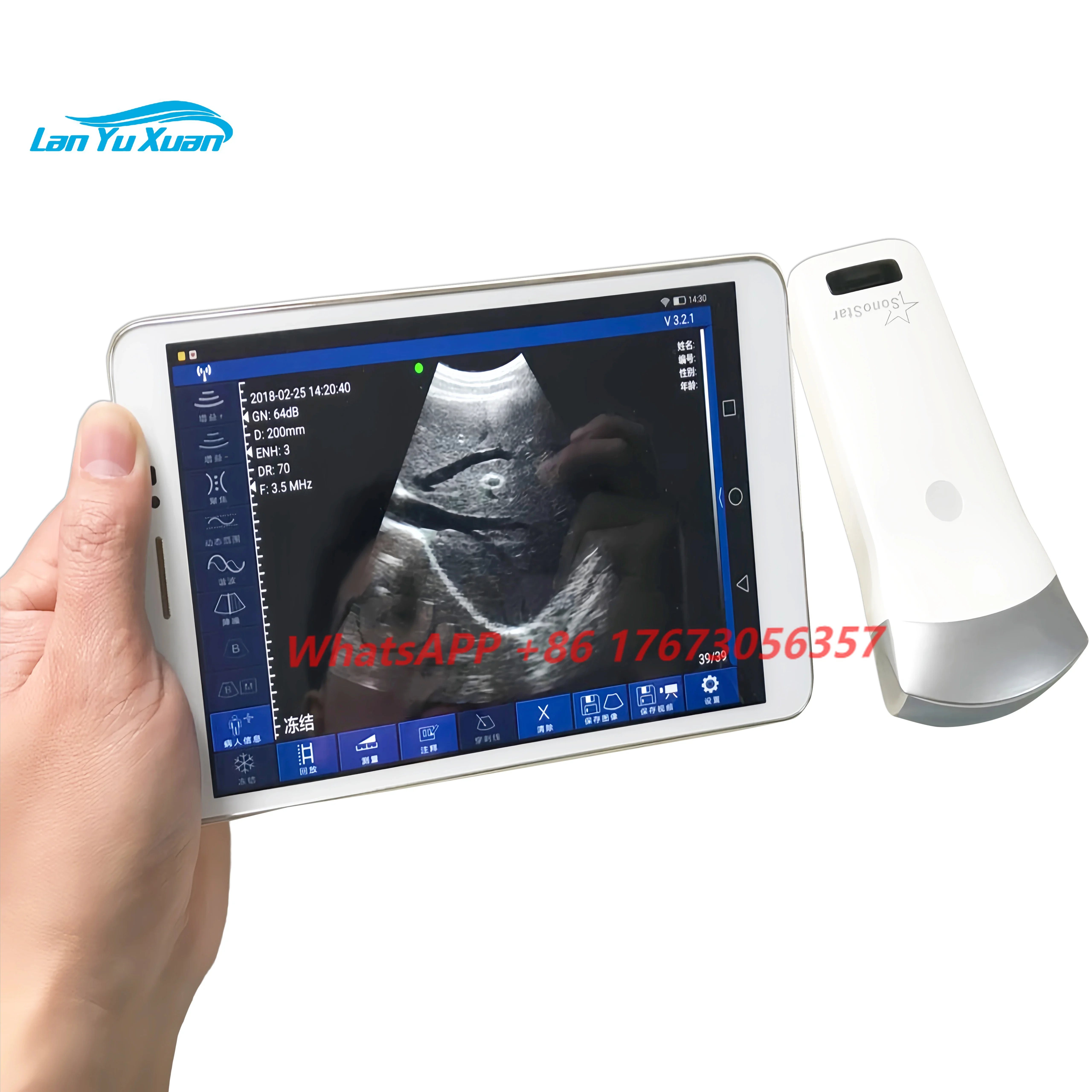 

Mini Medical 3 In 1 4200mAh Electronic Convex Array Scanning Phone Tablet IOS Android Windows Wireless Ultrasound Probe Scanner