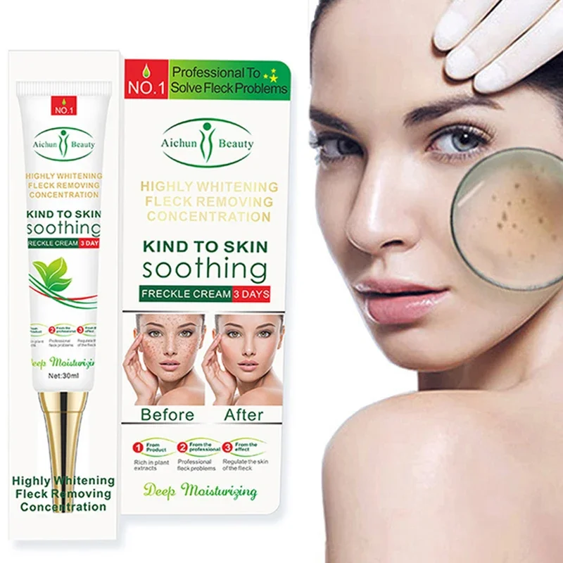 

Freckle Cream Remove Dark Spots Age Spots Sunburn Moisturizing Whitening Even Skin Tone Fades Pigmentation Facial Skin Care 30ml