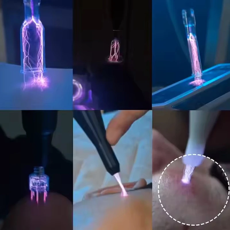 Newest 2 Handles Cold and Warm Plasma Hybrid Plasma Pen Ozone Eyelid Lift Hair Growth Acne Wrinkles Removal With 10 Heads