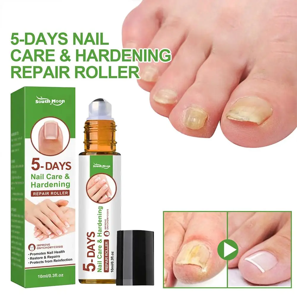 Nail Growth And Hardening Repair Roller Nail Repair Thickening Solution Brightening Removing Nutrient Soft N1W6 5 Days nail fungus remover manicure pedicure tools
