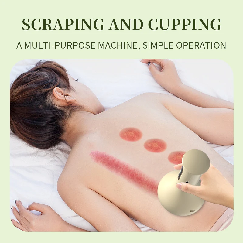 Vacuum Cupping Sets Intelligent Electric Cupping Machine Rechargeable Massage Tool with Negative Pressure Hot Compress Meridian Cupping Sendingelde