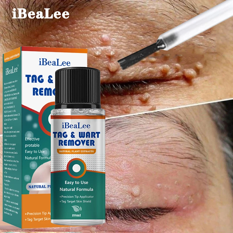 Ibealee Skin Wart Remover Serum Corn Tag Clean Painless Mole Skin Dark