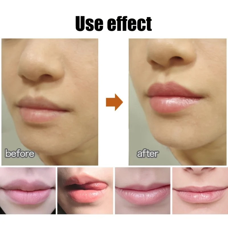 Cute Ball Shaped Lip Balm - Hydrating, Soothing, and Long-Lasting Lip Plumper with Non-Stick Cup for Preventing Frost Cracking a 4