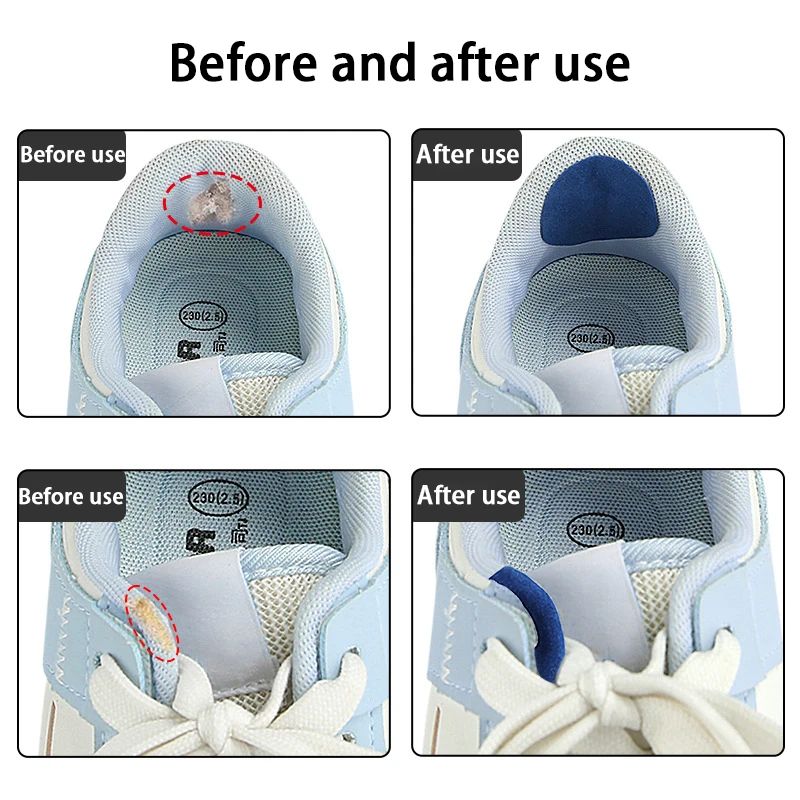 6 Pcs Upper Repair Stickers Sports Shoes Heel Anti Abrasion Patches Shoe Side Tear Repair Lining Hole Foot Care Products