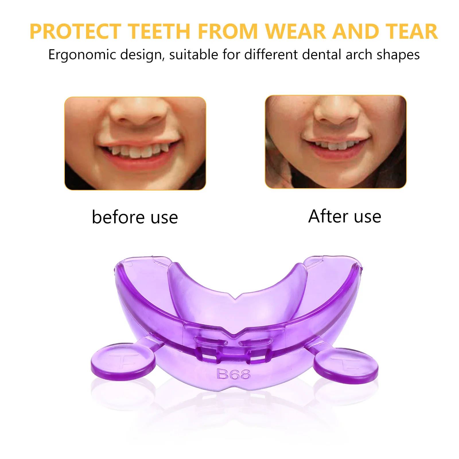 Tmj Splint Before And After corona.dothome.co.kr