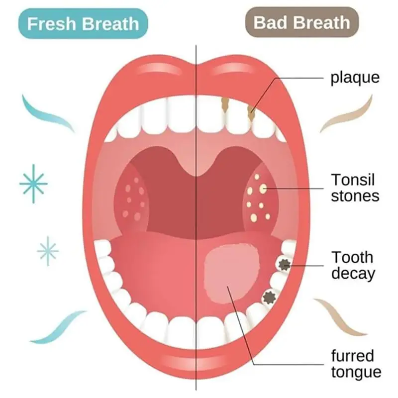 teeth whitening product teeth whitening essence teeth health product SP-7 Toothpaste Oral Health Management Deep Probiotic Whitening Toothpaste Fresh Breath Triple Whitening Teeth Product