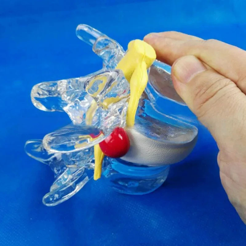 

AnatomicalHumanVertebraeSkeletonAnatomyDegenerativeLumbarDiscHerniationDemonstrationModelSpineMedicalAids