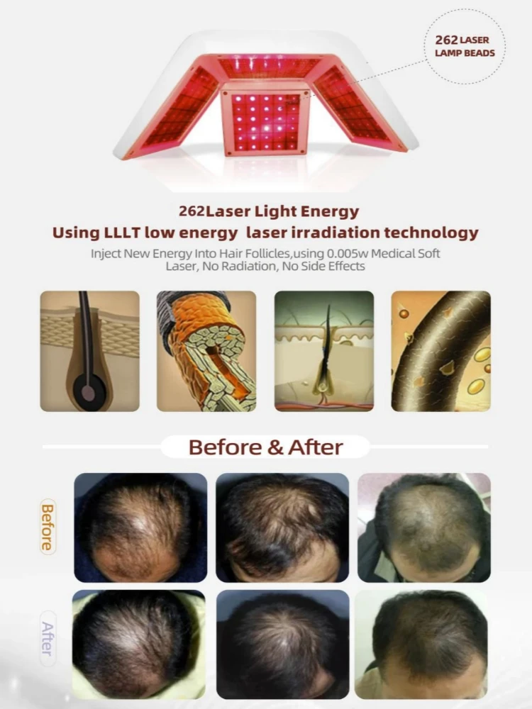 Рисунок 5 - Продукты для роста волос La-Ser нм для мужчин и женщин