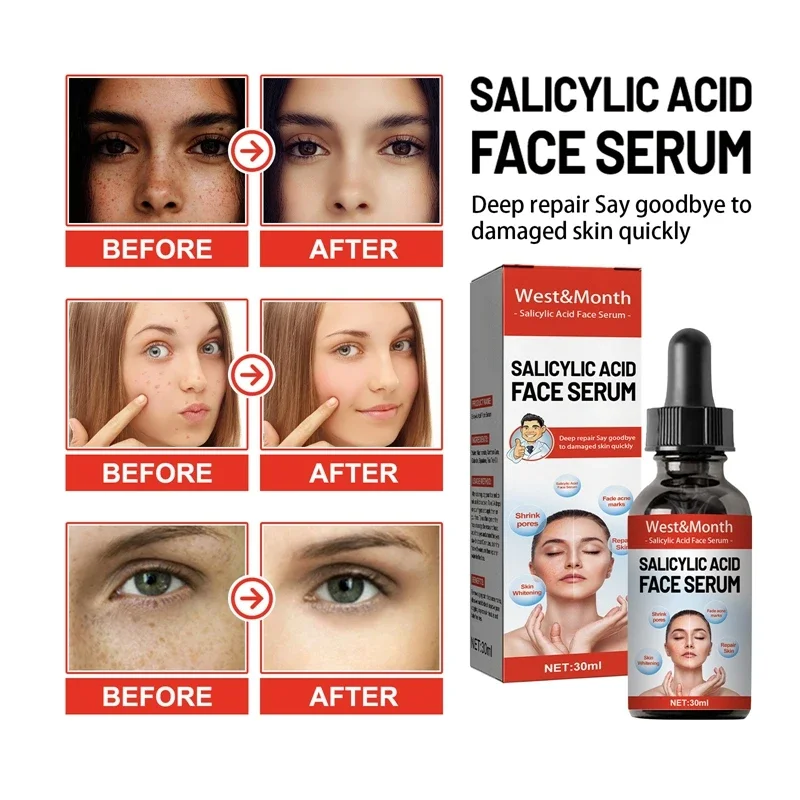 Niacinamide Facial Serum Salicylic Acid Moisturizing Skin Care Products 2024 3