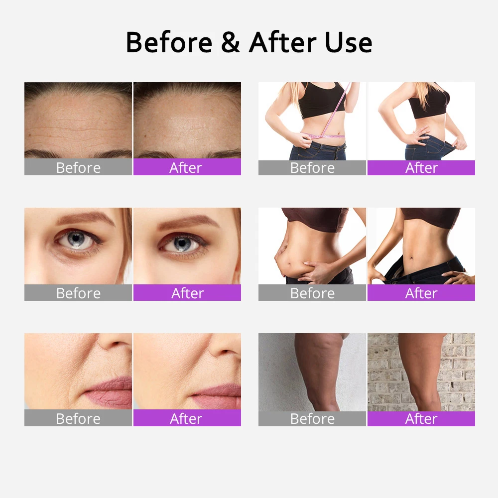 Mychway 9 In 1 40k Cavitation Machine Vacuum Body Slimming Fat Burner Wrinkle Removal Multifunctional Beauty Device