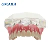 Dental Teeth Model with Implant Overdenture Inferior Demo Mandibular Model Dentist Student Learning Model 5