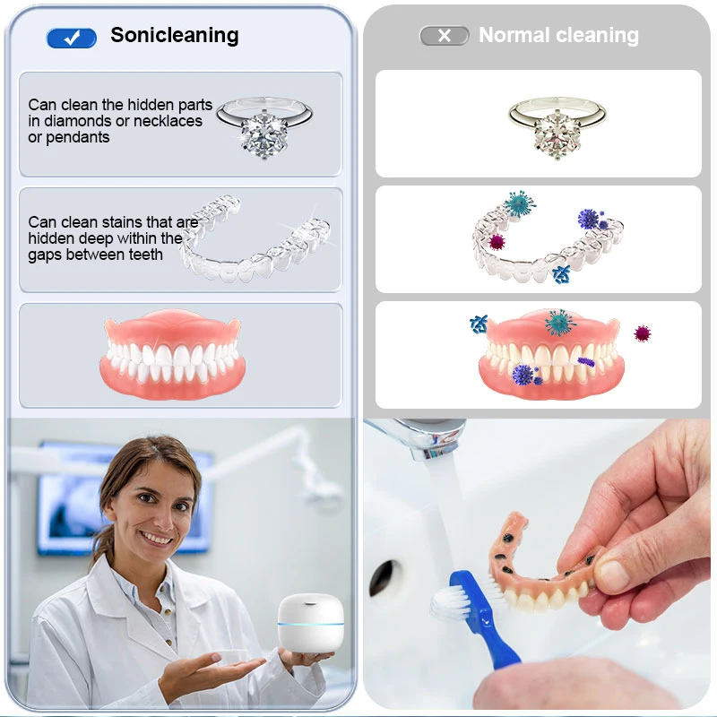 Household Ultrasonic UV Cleaner Kit For Jewelry False Teeth Aligner Retainer