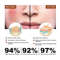 Crème réparatrice pour les rougeurs du visage, améliore la sécheresse des peaux sensibles, Lotion apaisante hydratante, élimination de la rosacea, cosmétiques coréens de jour et de nuit 5