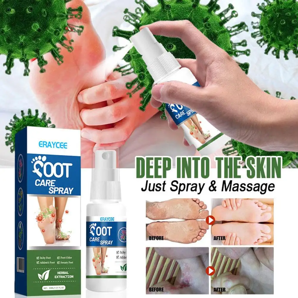 30ml Foot Deodorant Spray Relieve Itching Eliminate Spray Athlete's Foot Of Moisturize The Removal Foot Care Odor Anti-Swea B9M2
