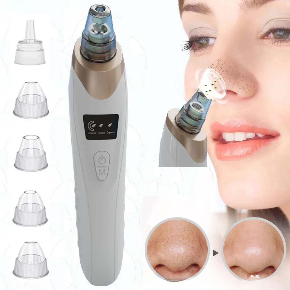 New Electric Blackhead Export Instrument Blackhead Artifact Pore Cleaner Beauty Instrument Large Suction