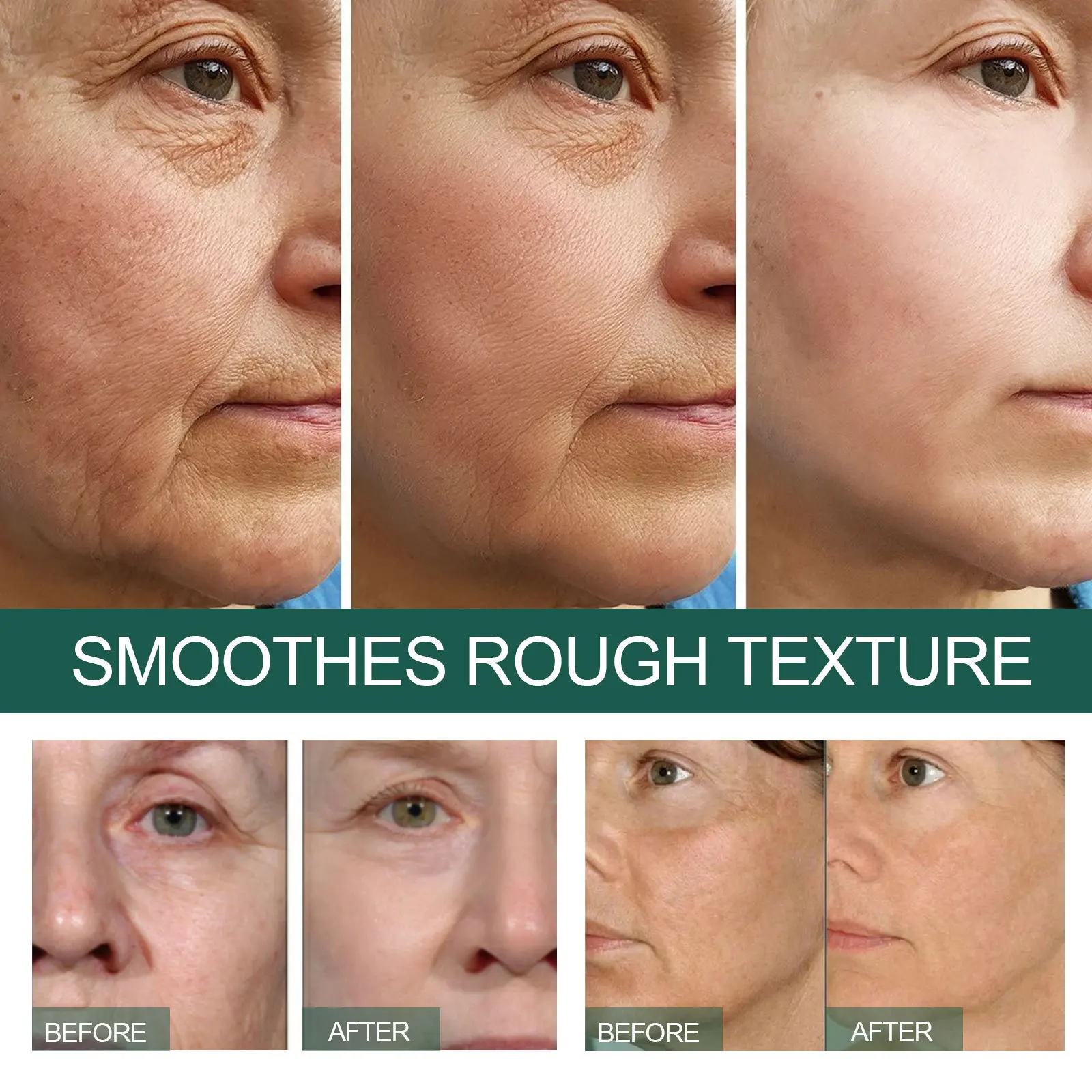 Anti-Falten-Serum, Anti-Aging, Entfernung von Augenringen, Stirnfalten, Gesichtspflege, Zornesfalten, Reparatur von Gesichtsessenz, 30 ml, weiblich_voghion.com