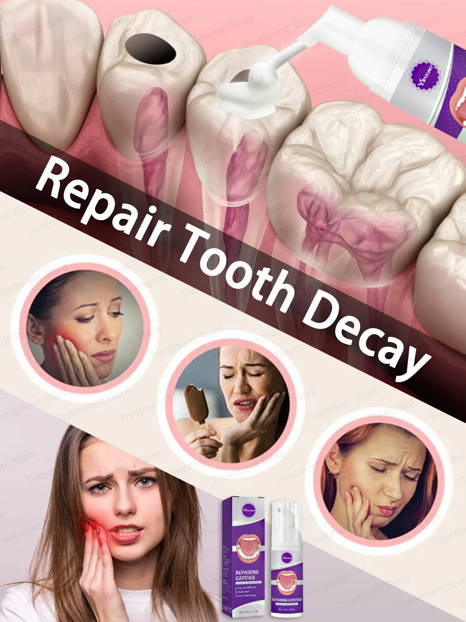 AntiDecayToothpasteDentalCariesRepairSerumPreventToothDecay
