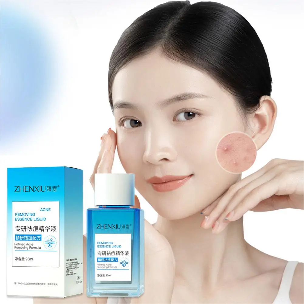 20ML Acne Removal Serum Treatment Acne Pimples Pore Oil Facial Skin Shrinking Smooth Repair Control Anti-acne Cleaning Care H2J5