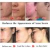 Kojic Acid Glow Soap Facial Deep Cleaning Even Skin Tone Skin Lightening Soap Oil Control Moisturizing Skin Care 65g x2 4