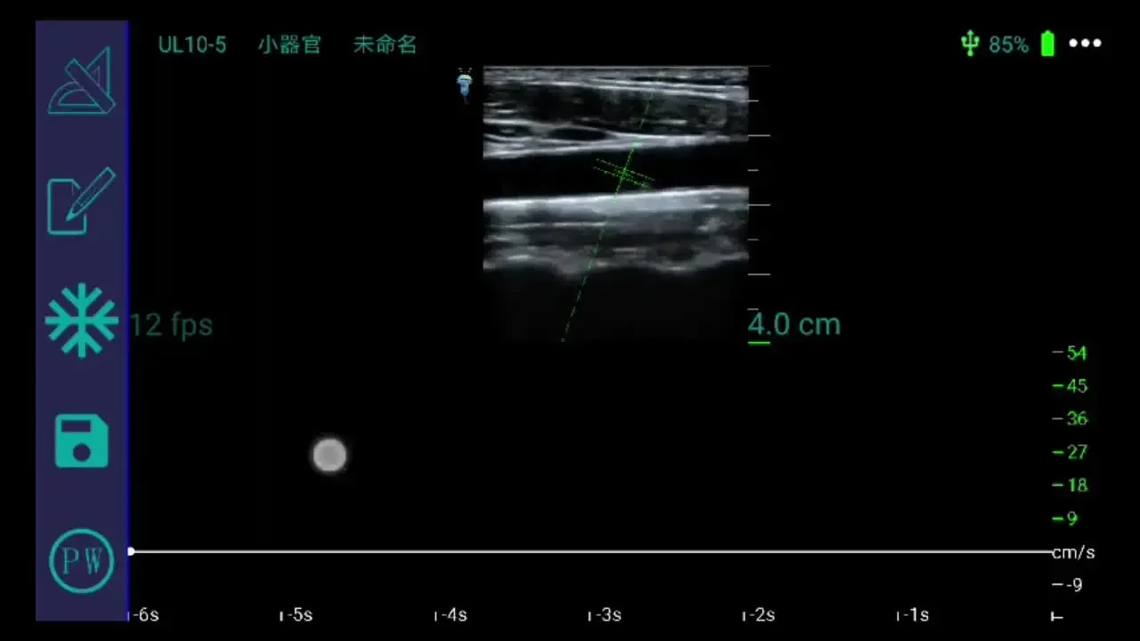 Portable 7.5Mhz USB linear probe ultrasound transducer best price USB ultrasound probe