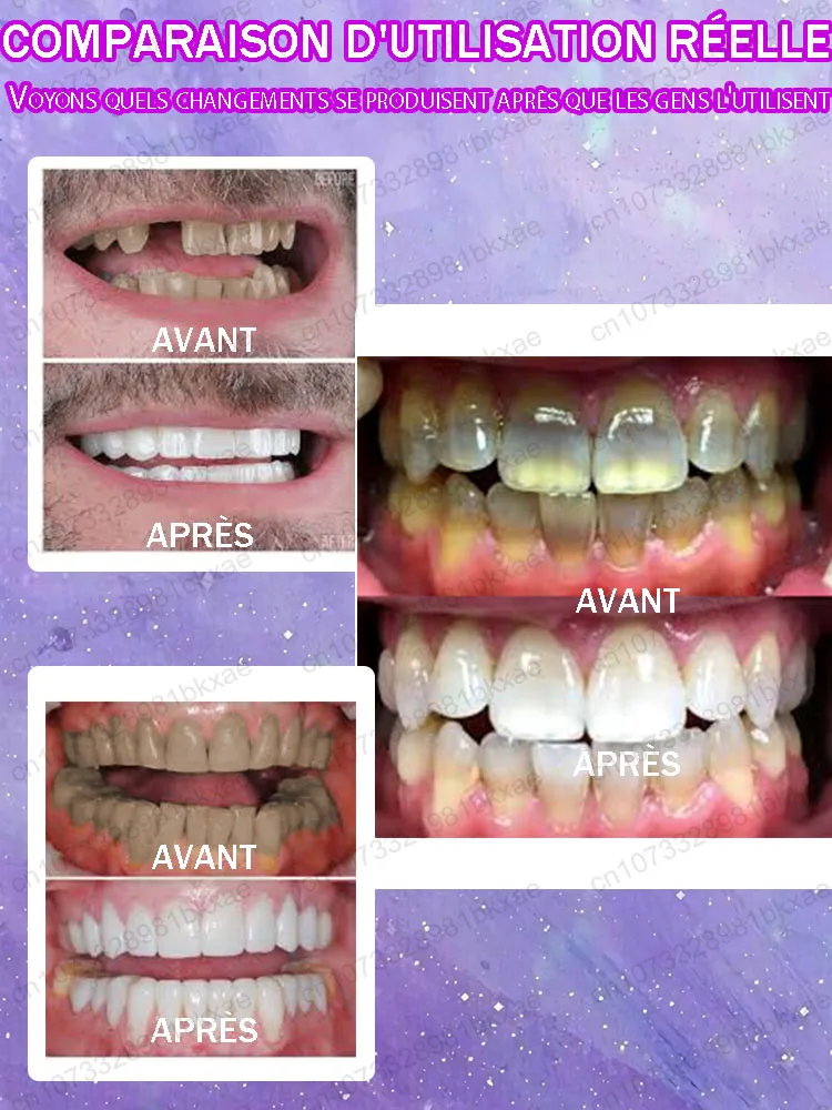 Teeth whitening anti-cavity tooth decay fresh bad breath repair tooth decay remove plaque toothache relieve periodontitis
